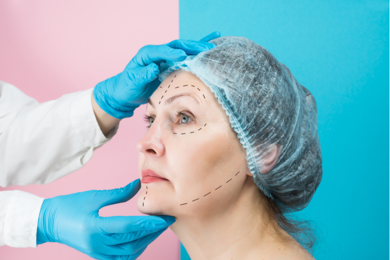 Plastic and Cosmetic Surgeries - Facelift and Necklift