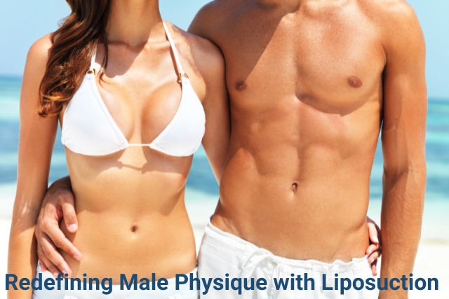 male liposuction