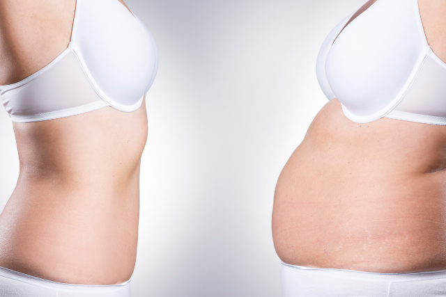 how to know when you need a tummy tuck