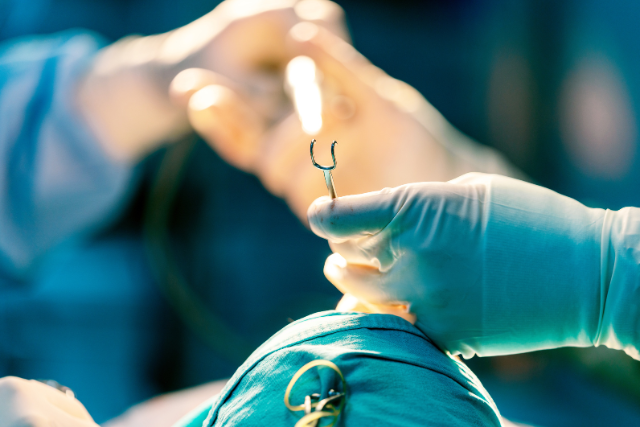Rhinoplasty for Men