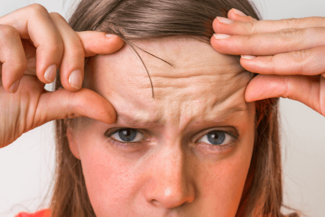 Brow Lift Surgery
