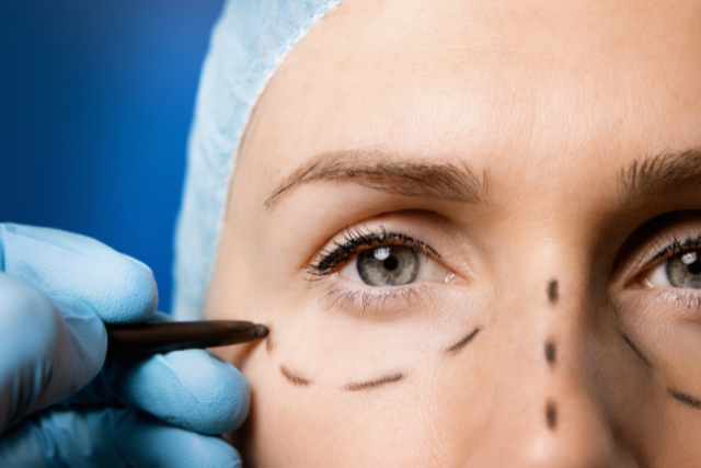 What Is FaceTite and How Does It Work?