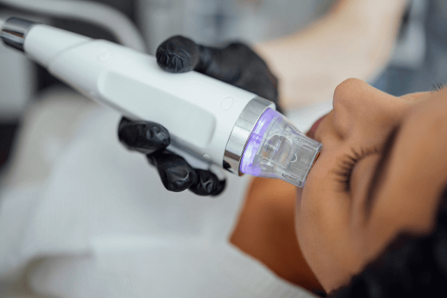 What is Microneedling?