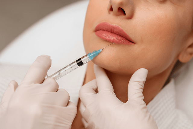 What Is a Lip Augmentation?
