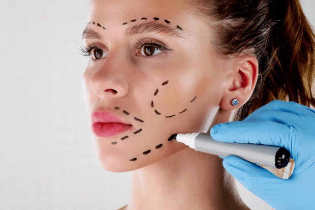 Types of Facelift