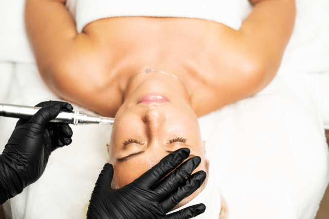 Microneedling While Pregnant