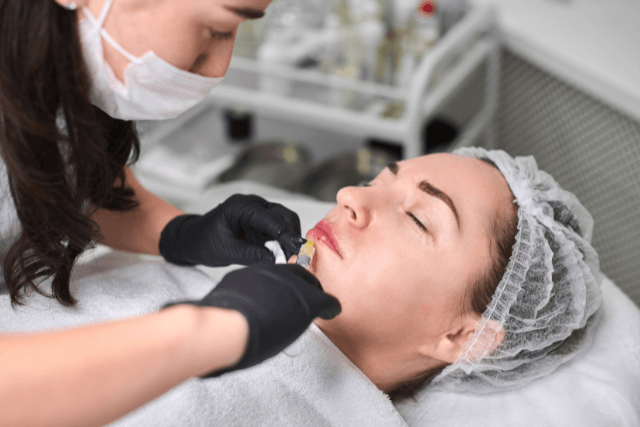 Dissolving Lip Filler