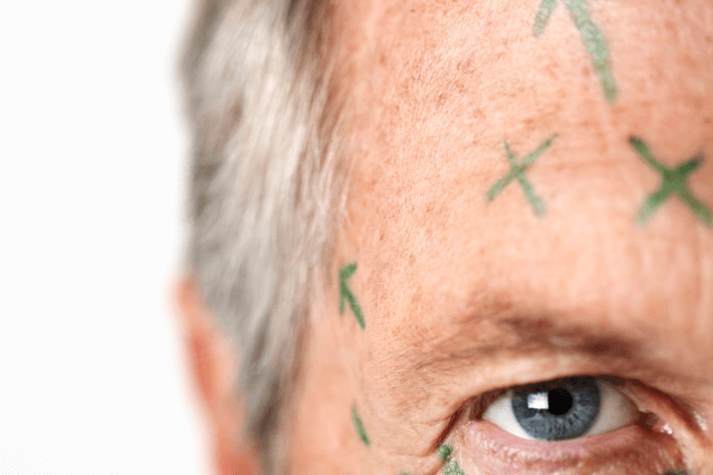 Male Facelift Trends 2026