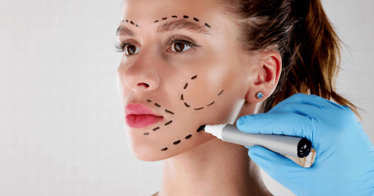 What Is a Mini Facelift