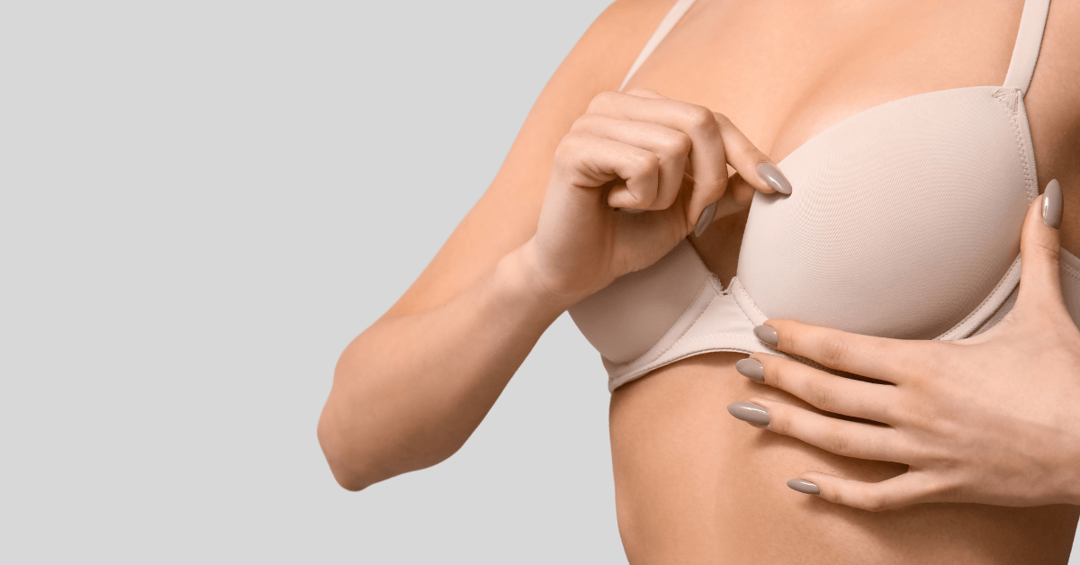 Breast lift scars