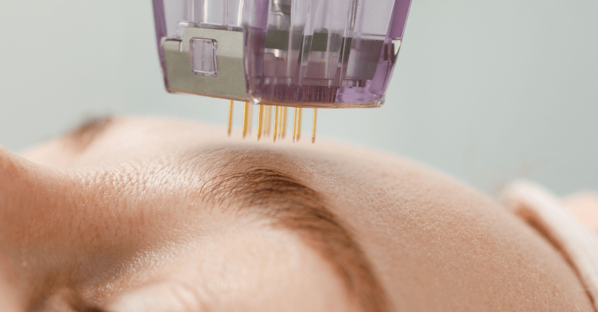 Non Invasive Skin Rejuvenation Treatments in Hudson