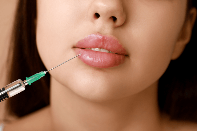 Lip Filler Recovery and Aftercare