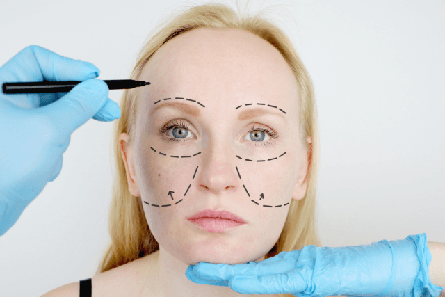 Sleeping After A Facelift Surgery