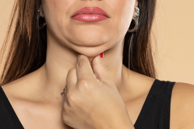 Liposuction For Double Chin Elimination